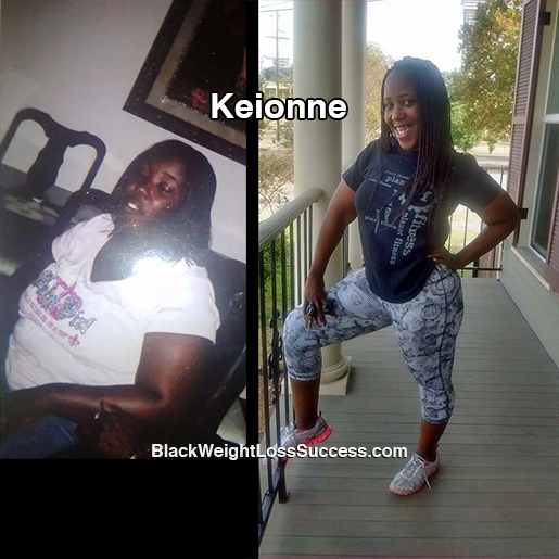 Keionne before and after