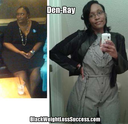 den-ray before and after photo