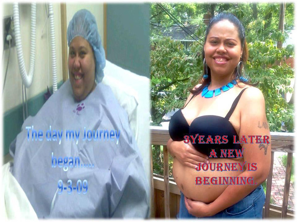 Linda lost 315 pounds