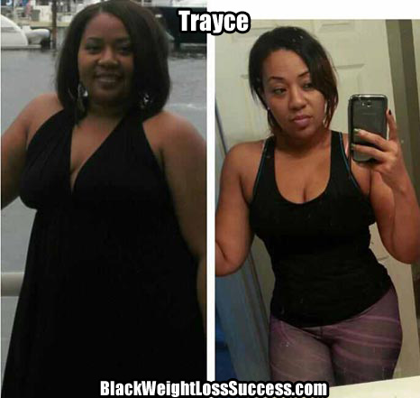 Trayce Madre weight loss story