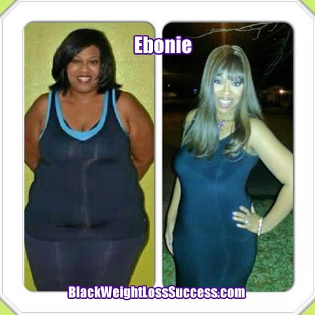 Ebonie weight loss surgery