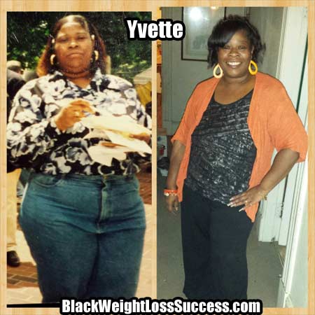 Yvette before and after weight loss