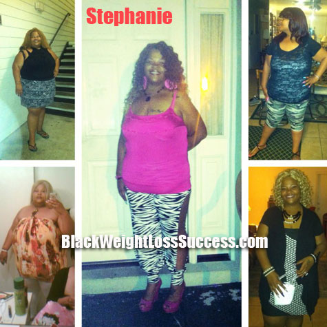 Stephanie weight loss surgery