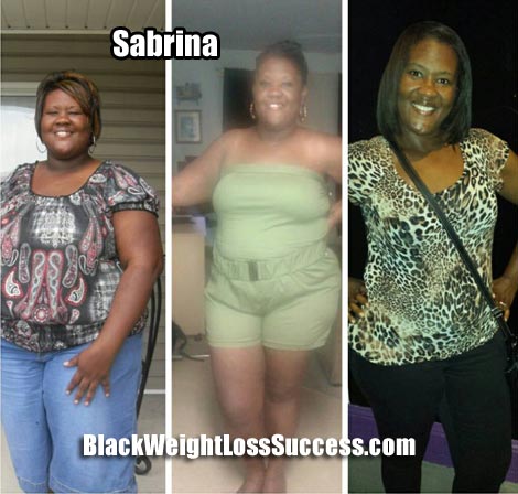 Sabrina weight loss surgery