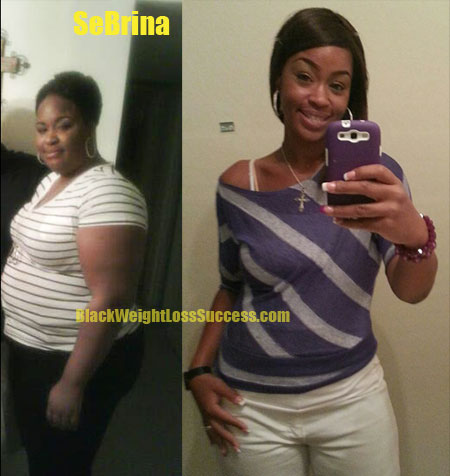 Sebrina weight loss surgery