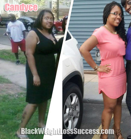 Candyce weight loss pictures