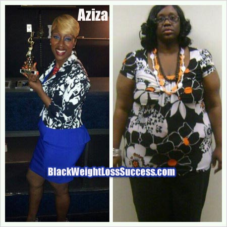 Aziza weight loss surgery story