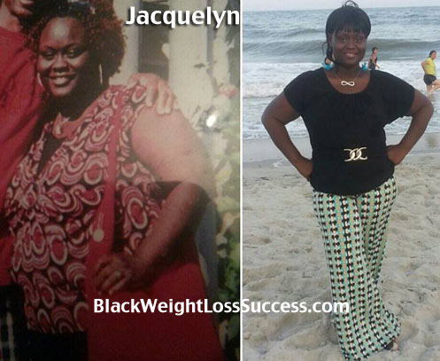Jacquelyn weight loss story