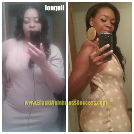 Jonquil weight loss story