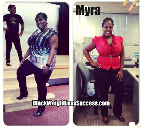 Myra weight loss before & after