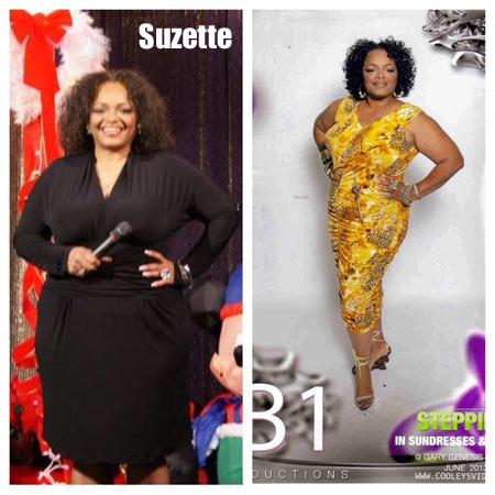 Suzette weight loss story