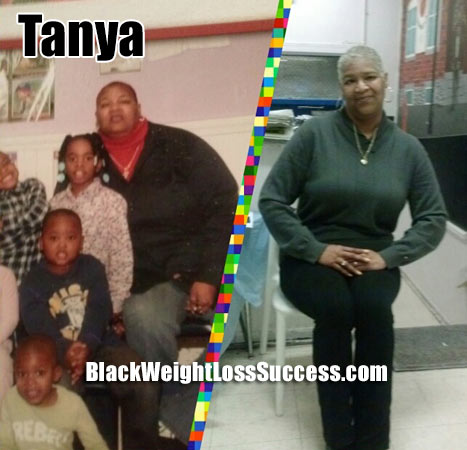 Tanya gastric bypass surgery