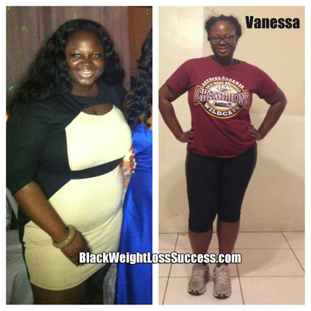 Vanessa weight loss story