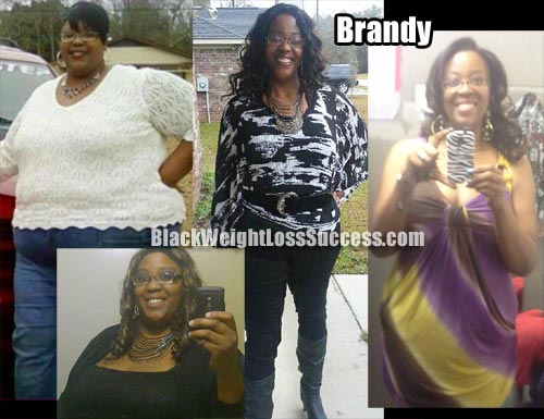 Brandy weight loss surgery photos