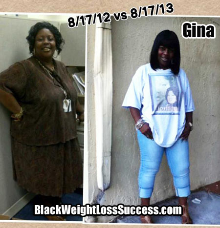 Gina gastric bypass