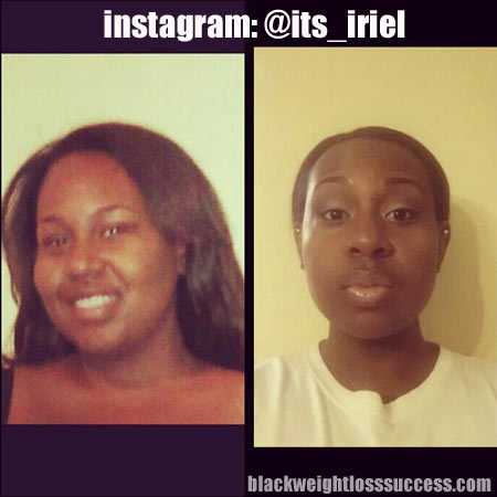 Iriel weight loss story