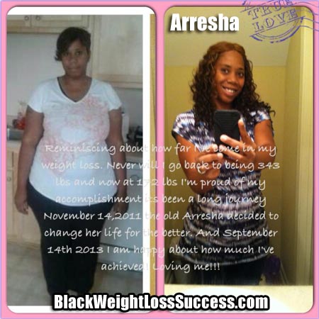Arresha weight loss surgery