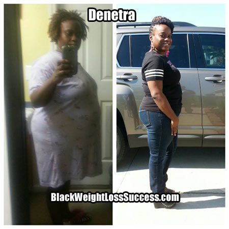 Denetra before and after photos