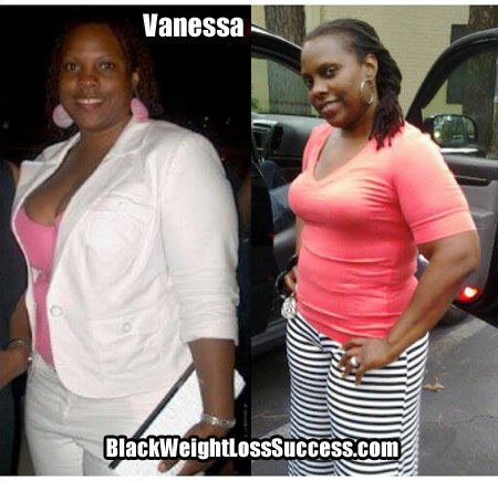 Vanessa weight loss story