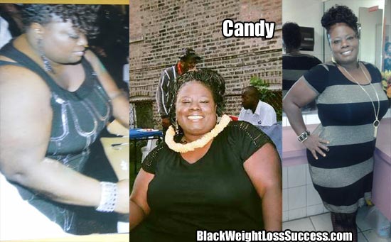 Candy weight loss story