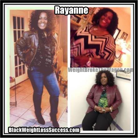 Rayanne before and after photos