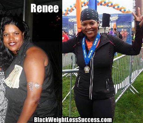 Renee before and after photos