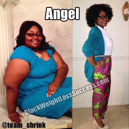 Angel before and after weight loss surgery
