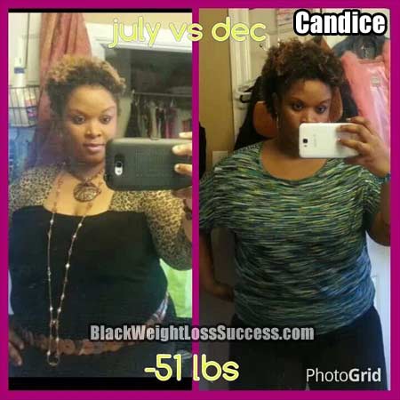 Candice before and after weight loss