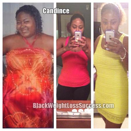 Candince weight loss photos