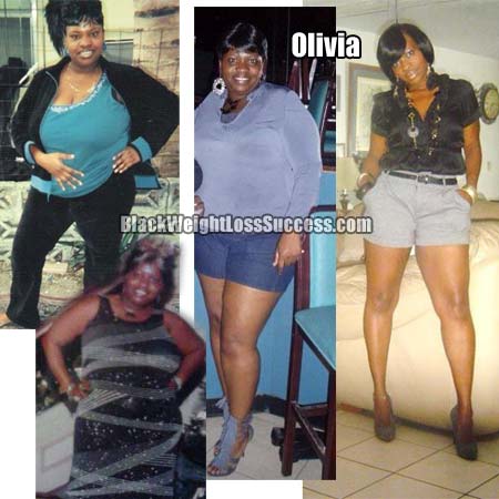 Olivia weight loss surgery