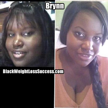 Brynn before and after