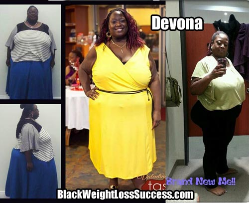 Devona weight loss