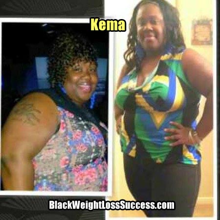 Kema before and after