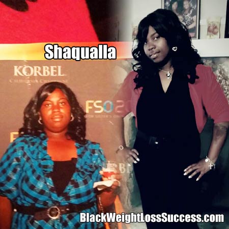 Shaqualla gastric sleeve results
