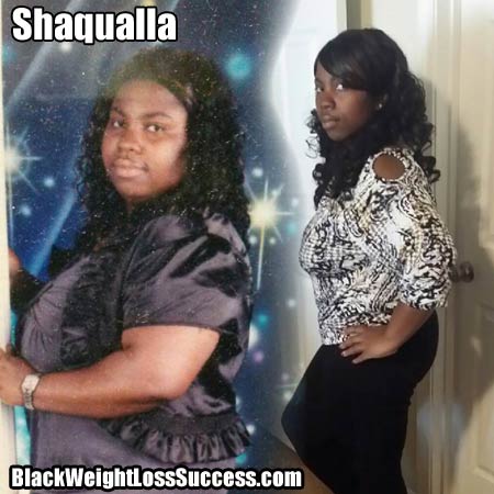 Shaqualla weight loss surgery