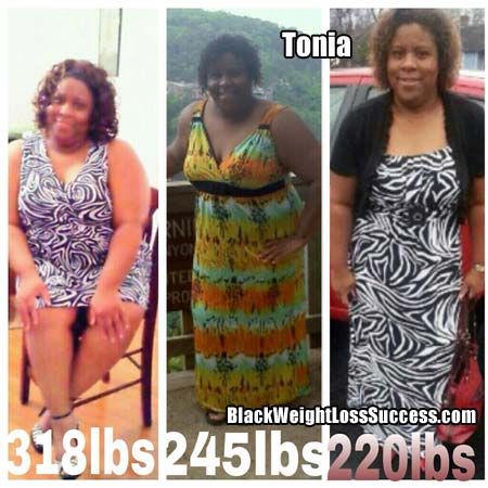 Tonia before and after weight loss