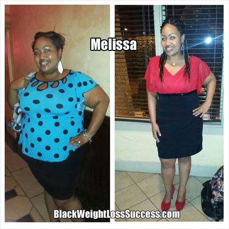 melissa weight loss surgery