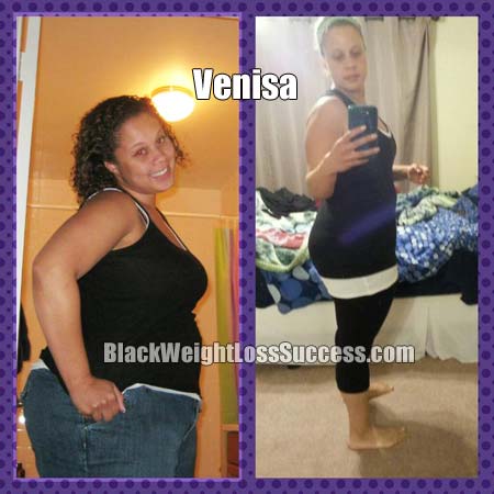 Venisa before and after