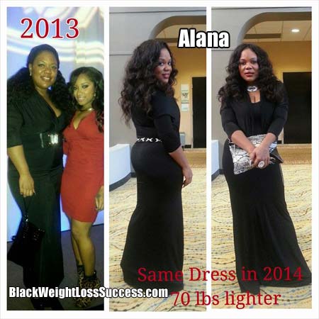 Alana weight loss story