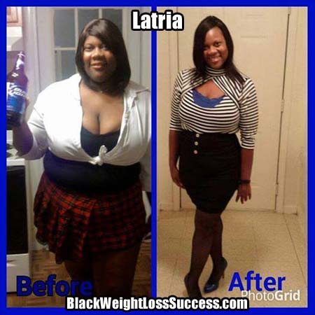 Latria weight loss surgery