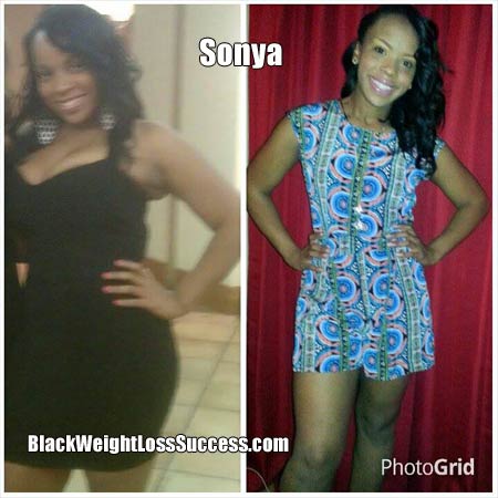 Sonya before and after