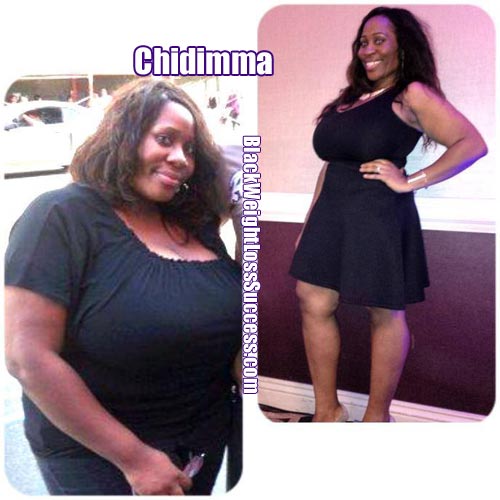Chidimma before and after