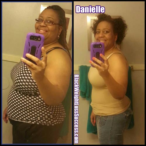 Danielle weight loss surgery