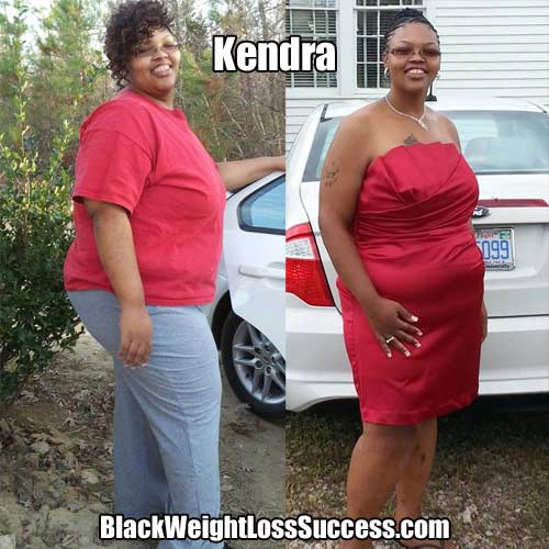 Kendra weight loss surgery