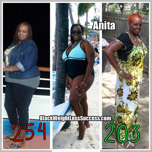 Anita weight loss surgery