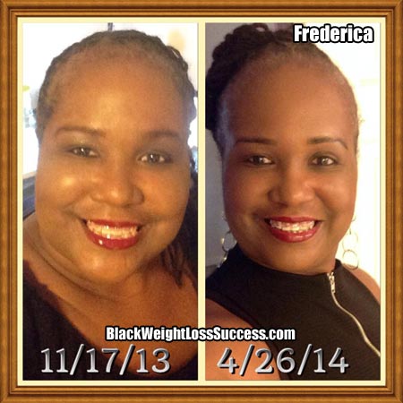 Fredericka before and after