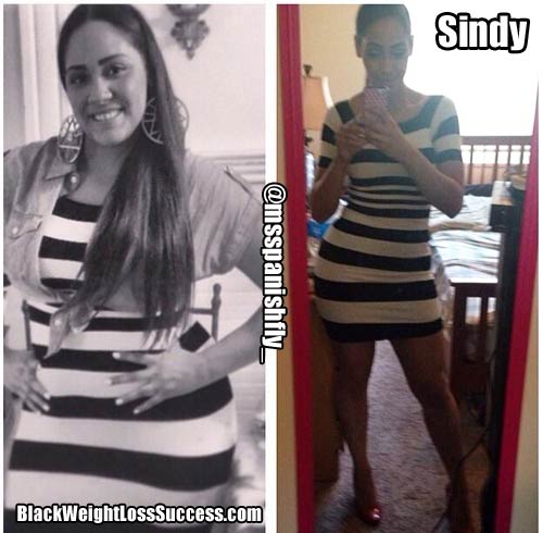 Sindy before and after