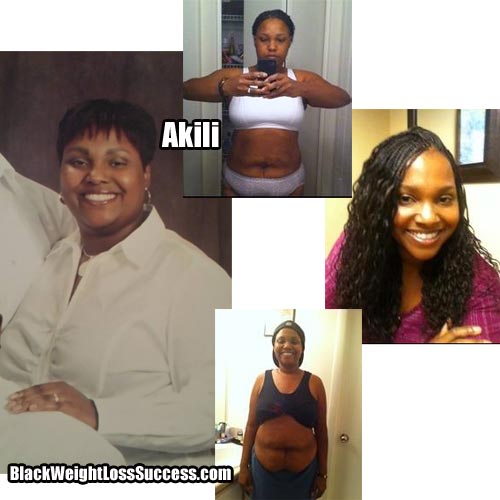 Akili weight loss success story