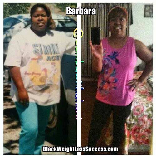 Barbara before and after