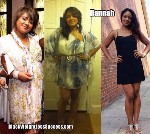 Hannah weight loss story